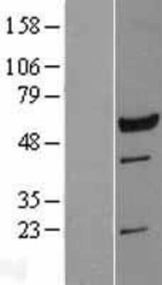 Western Blot: LRRC6 Overexpression Lysate [NBL1-12702]