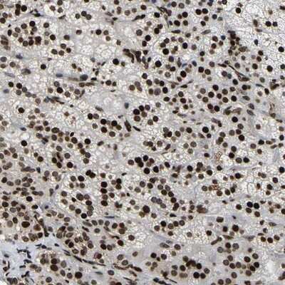 Immunohistochemistry-Paraffin: LRRC61 Antibody [NBP1-82021]