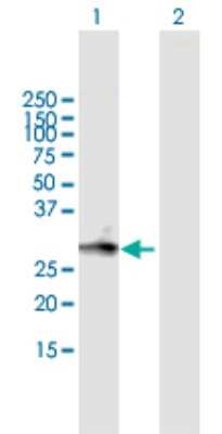 Western Blot: LRRC61 Antibody [H00065999-B01P]