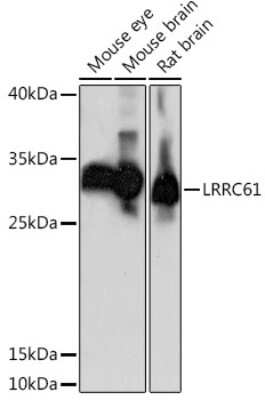 Western Blot: LRRC61 AntibodyAzide and BSA Free [NBP3-04593]