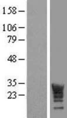 Western Blot: LRRC61 Overexpression Lysate [NBP2-09674]