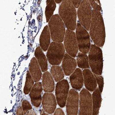 Immunohistochemistry: LRRC63 Antibody [NBP1-90671]