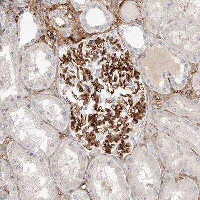 Immunohistochemistry: LRRC66 Antibody [NBP1-91040]