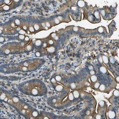 Immunohistochemistry: LRRC66 Antibody [NBP1-91098]