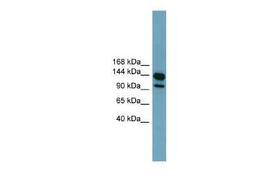 Western Blot: LRRC66 Antibody [NBP2-85233]