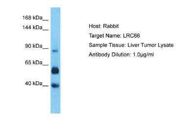 Western Blot: LRRC66 Antibody [NBP2-85235]