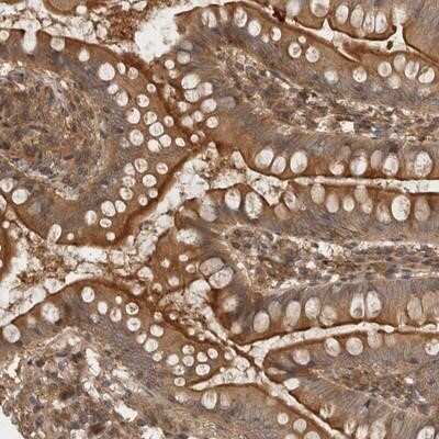 Immunohistochemistry-Paraffin: LRRC67 Antibody [NBP1-84046]