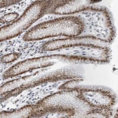 Immunohistochemistry-Paraffin: LRRC67 Antibody [NBP1-84047]