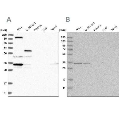 Western Blot: LRRC67 Antibody [NBP1-84047]