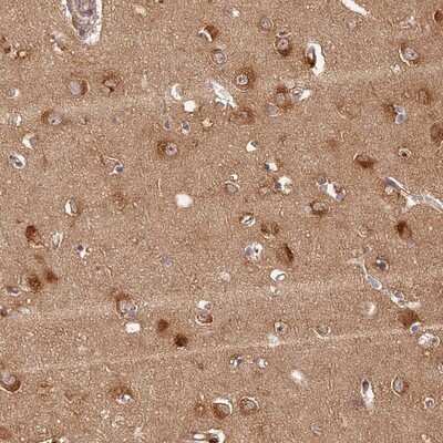 Immunohistochemistry-Paraffin: LRRC68 Antibody [NBP1-90889]