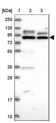 Western Blot: LRRC68 Antibody [NBP1-90889]