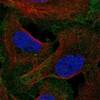 Immunocytochemistry/ Immunofluorescence: LRRC69 Antibody [NBP2-14566]