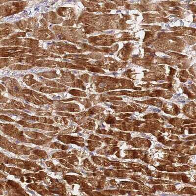 Immunohistochemistry-Paraffin: LRRC69 Antibody [NBP2-14566]