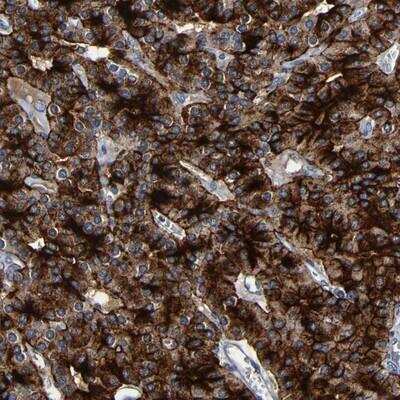 Immunohistochemistry: LRRC70 Antibody [NBP1-93554]