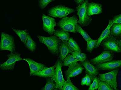 Immunocytochemistry/ Immunofluorescence: LRRC8B Antibody [NBP2-97498]