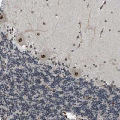 Immunohistochemistry-Paraffin: LRRC8B Antibody [NBP1-81532]