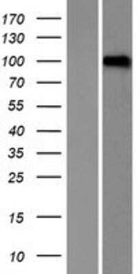 Western Blot: LRRC8D Overexpression Lysate [NBP2-06853]