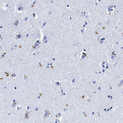 Immunohistochemistry-Paraffin: LRRC8E Antibody [NBP1-82078]