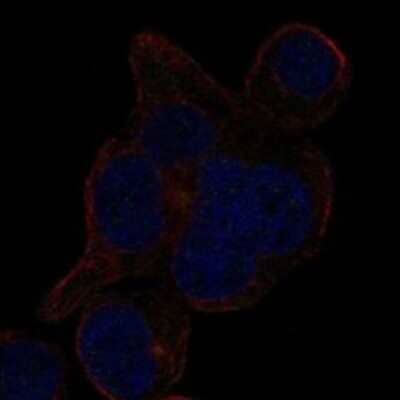 Immunocytochemistry/ Immunofluorescence: LRRCC1 Antibody [NBP3-17600]