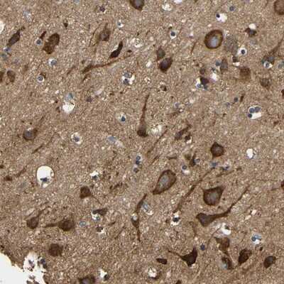 Immunohistochemistry-Paraffin: LRRCC1 Antibody [NBP1-93577]