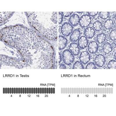 Immunocytochemistry/ Immunofluorescence: LRRD1 Antibody [NBP3-16965]