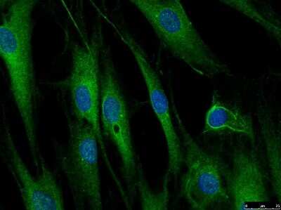 Immunocytochemistry/ Immunofluorescence: LRRFIP1 Antibody [NBP1-71835]