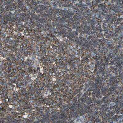 Immunohistochemistry-Paraffin: LRRFIP1 Antibody [NBP1-84665]