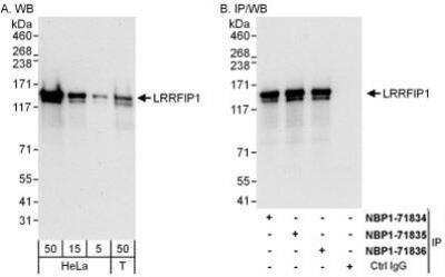 Western Blot: LRRFIP1 Antibody [NBP1-71835]