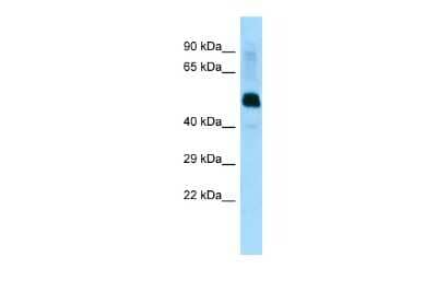 Western Blot: LRRFIP1 Antibody [NBP2-87744]