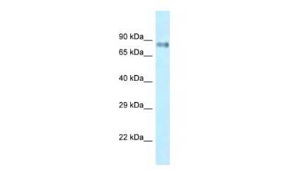 Western Blot: LRRFIP1 Antibody [NBP2-87746]