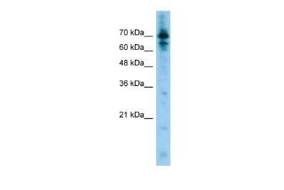 Western Blot: LRRFIP1 Antibody [NBP2-87747]