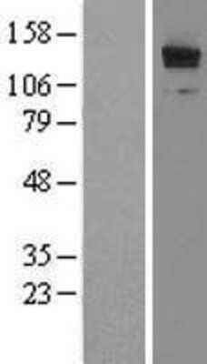 Western Blot: LRRFIP1 Overexpression Lysate [NBL1-12709]