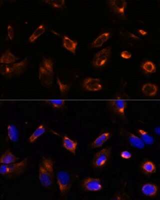 Immunocytochemistry/ Immunofluorescence: LRRFIP2 Antibody - Azide and BSA Free [NBP3-15516]