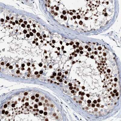 Immunohistochemistry-Paraffin: LRRFIP2 Antibody [NBP1-83147]