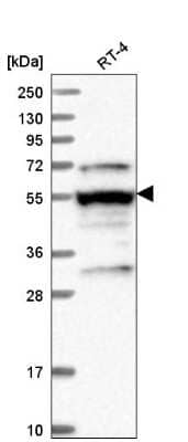 Western Blot: LRRFIP2 Antibody [NBP2-58998]