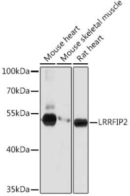 Western Blot: LRRFIP2 AntibodyAzide and BSA Free [NBP3-15516]