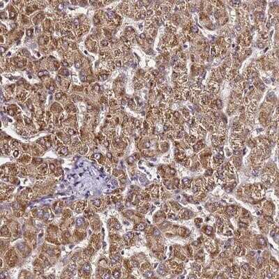 Immunohistochemistry-Paraffin: LRRIQ1 Antibody [NBP1-92080]