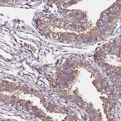 Immunohistochemistry-Paraffin: LRRIQ1 Antibody [NBP1-92080]