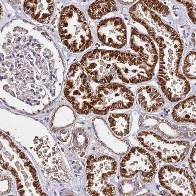 Immunohistochemistry-Paraffin: LRRIQ1 Antibody [NBP1-92080]