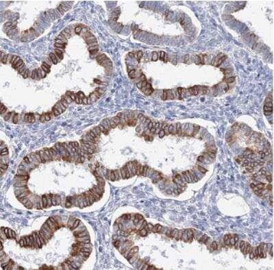 Immunohistochemistry: LRRIQ4 Antibody [NBP2-30956]