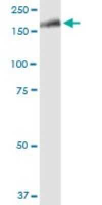 Western Blot: LRRK1 Antibody [H00079705-B01P]