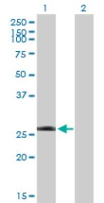 Western Blot: LRRK1 Antibody [H00079705-B01P]