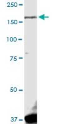 Western Blot: LRRK1 Antibody [H00079705-D01P]