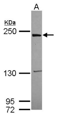 Western Blot: LRRK1 Antibody [NBP2-17173]