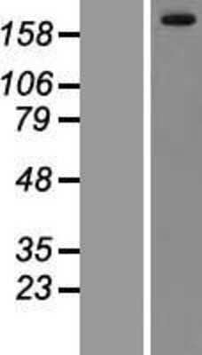 Western Blot: LRRK1 Overexpression Lysate [NBP2-06308]