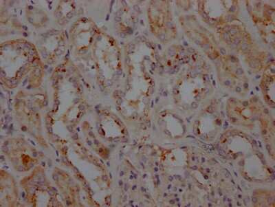 Immunohistochemistry: LRRK2 Antibody (4E9) [NBP3-15156]