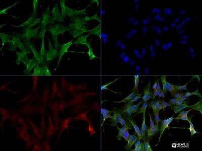 Immunocytochemistry/ Immunofluorescence: LRRK2 Antibody - BSA Free [NB300-268]