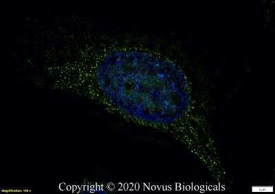Immunocytochemistry/ Immunofluorescence: LRRK2 Antibody - BSA Free [NB300-268]