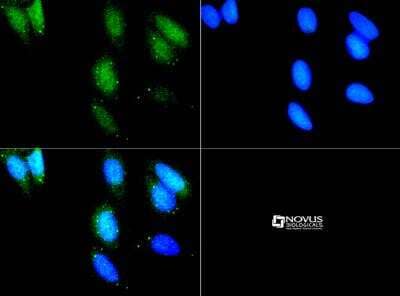 Immunocytochemistry/ Immunofluorescence: LRRK2 Antibody - BSA Free [NBP1-78299]