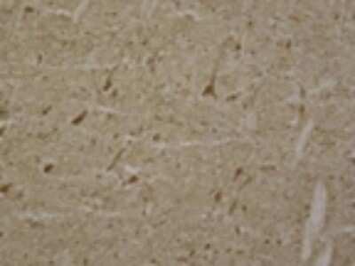 Immunohistochemistry-Frozen: LRRK2 Antibody [NB110-58771]